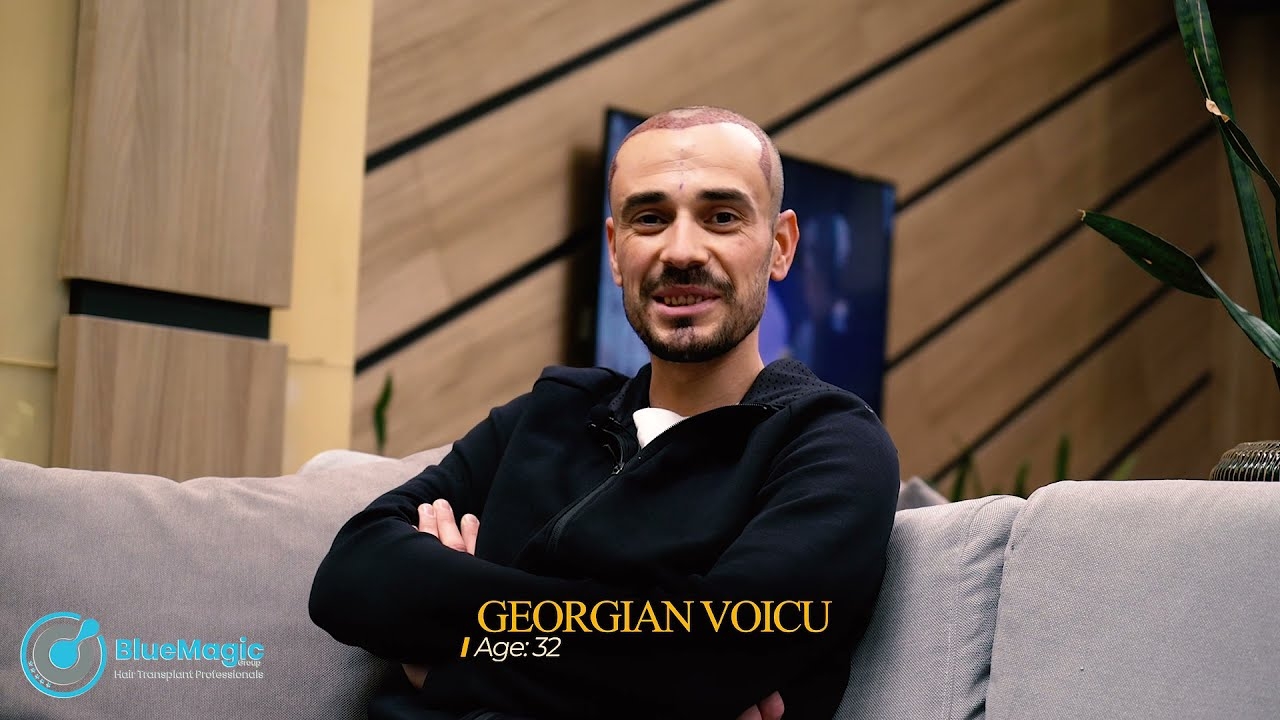 #HairTransplantTurkey | Georgian Voicu chooses BlueMagic Group | DHI Hair Transplant In Istanbul