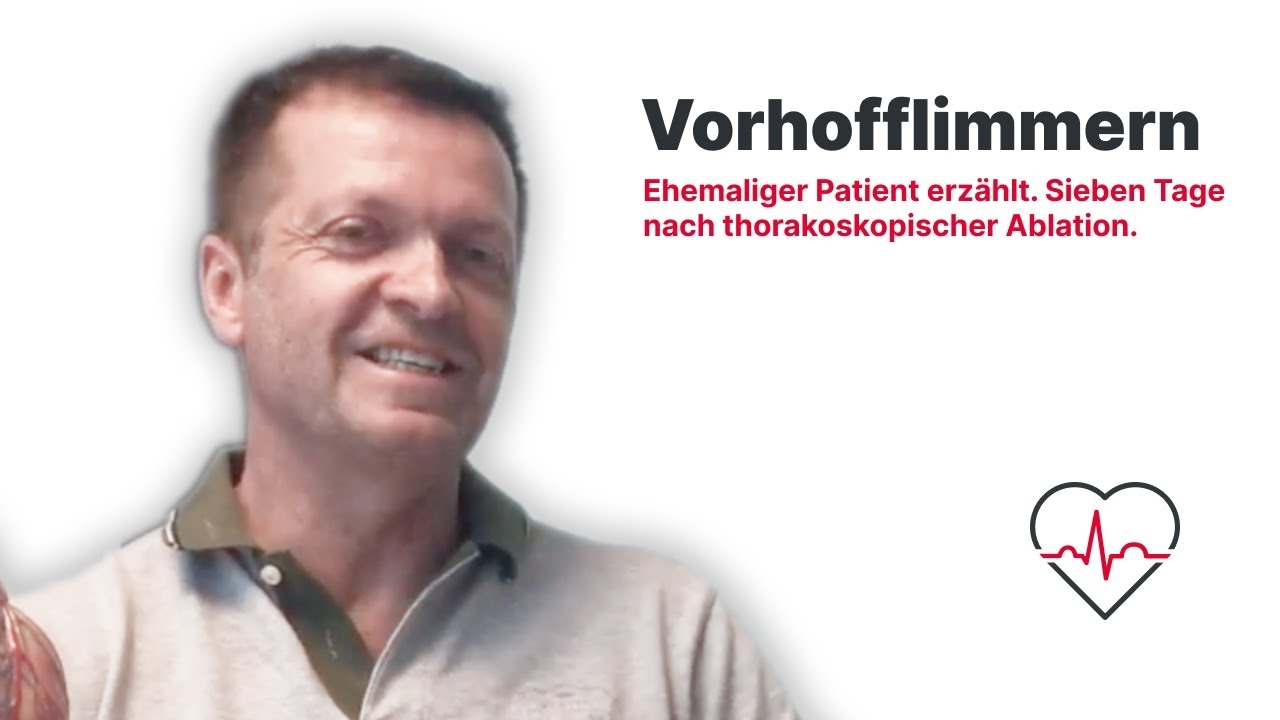 Persistent atrial fibrillation: Former patient talks | 7 days after thoracoscopic ablation