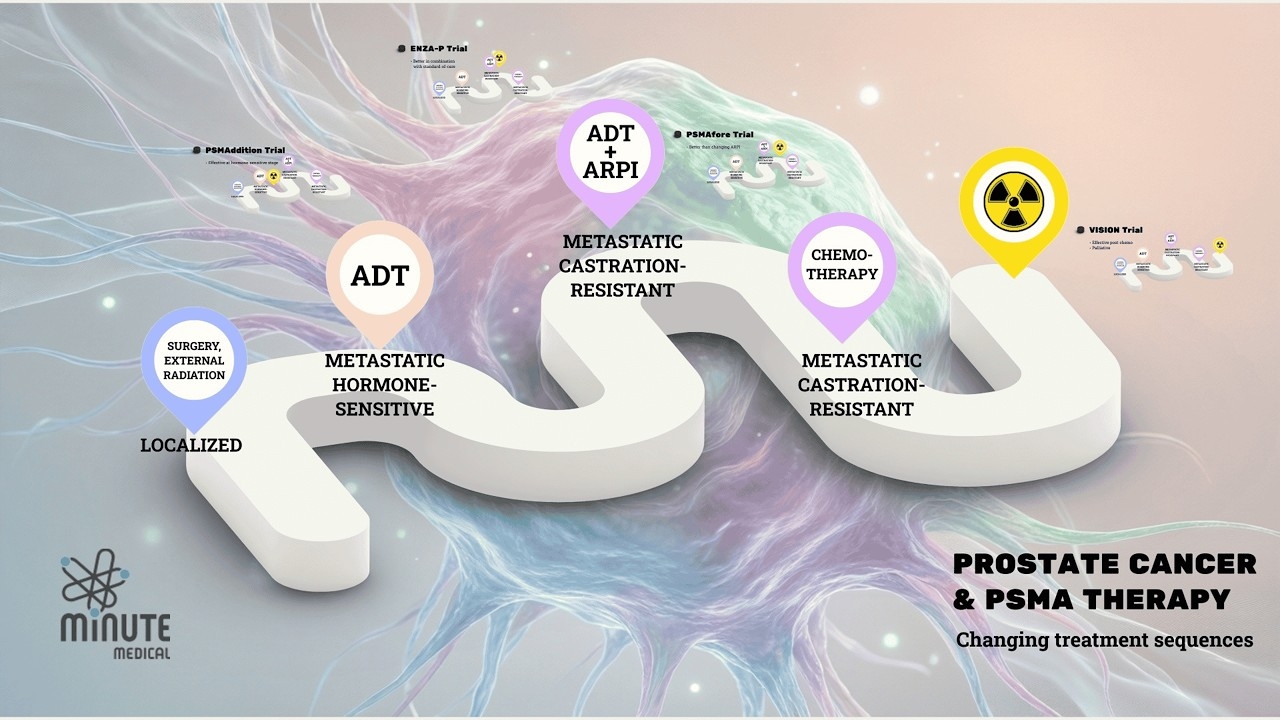 PSMA Therapy Earlier in the Prostate Cancer Treatment Sequence