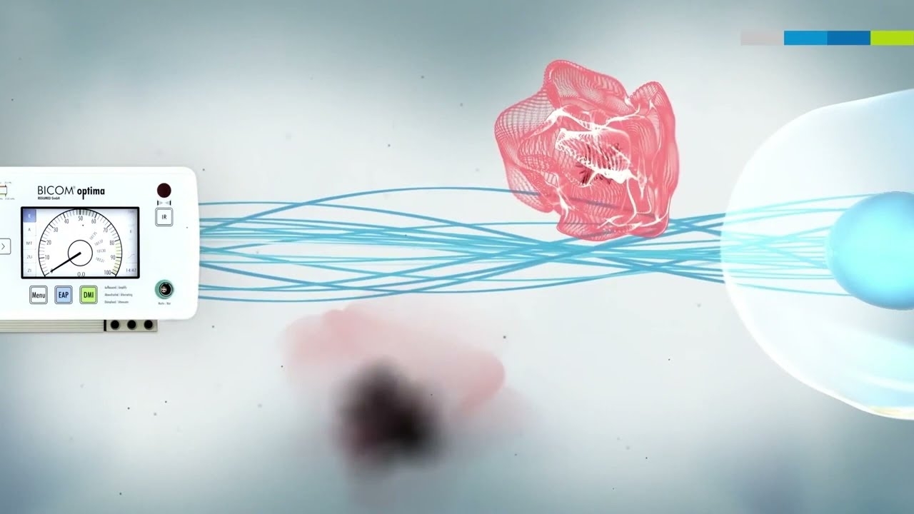 BICOM® Bioresonance How it works