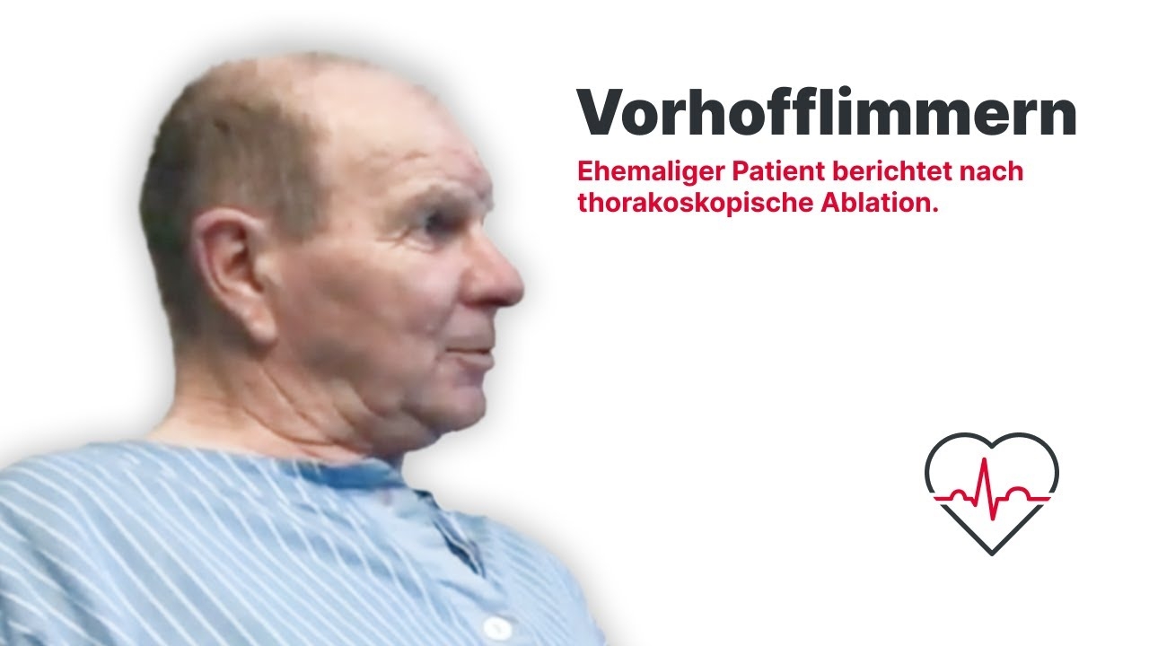 Atrial Fibrillation: Former Patient Tells | Thoracoscopic Ablation