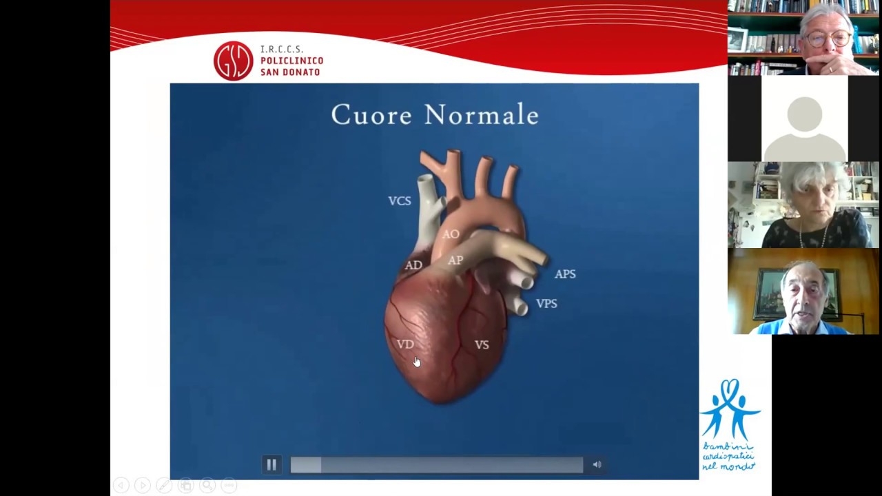 The interatrial defect: anatomy of interatrial defects - Alessandro Frigiola