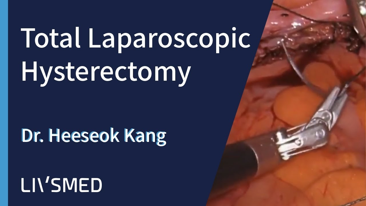 Total Laparoscopic Hysterectomy - Dr. Heeseok Kang