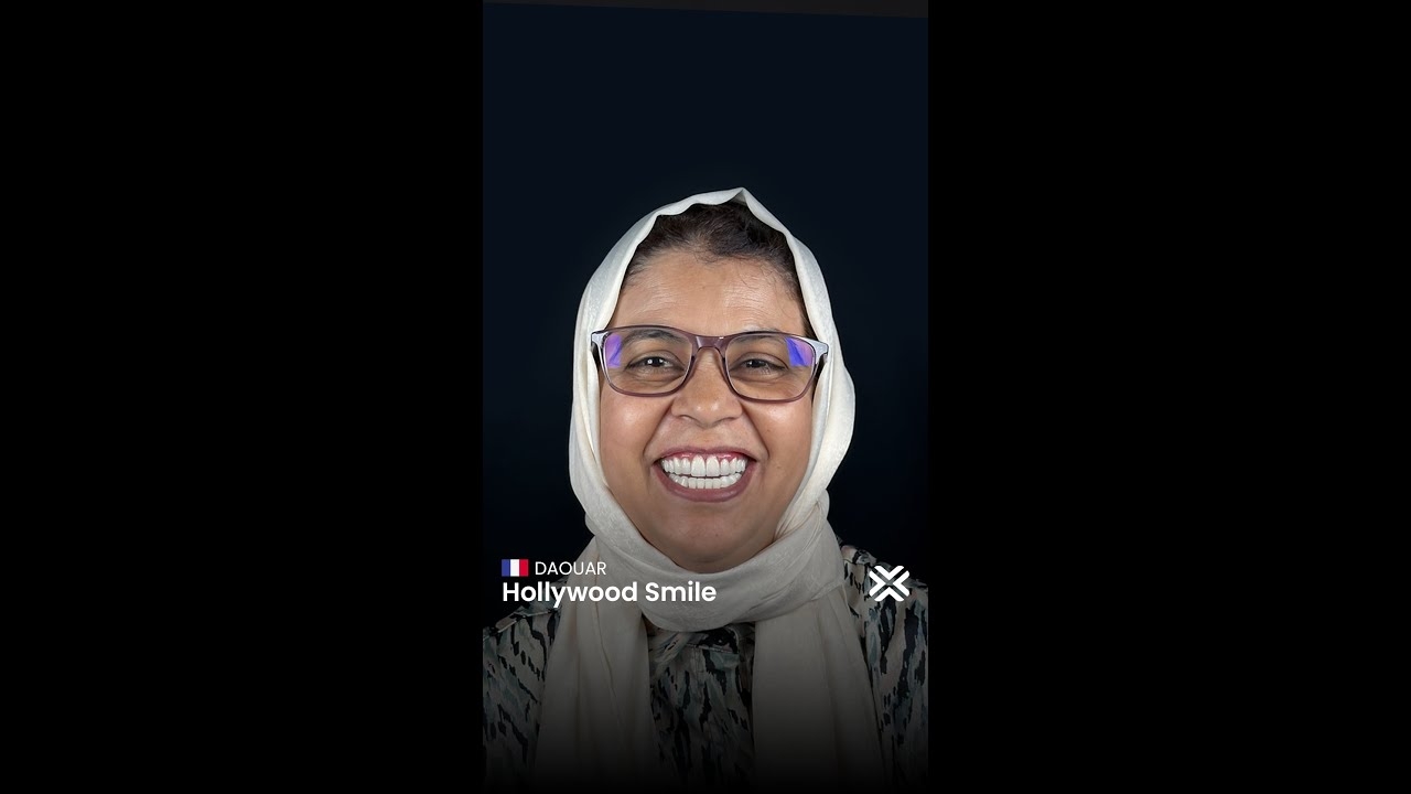 The Joy of New Teeth at Apex Clinic | Inteview #beforeandafter #dental #hollywoodsmile #dentalclinic