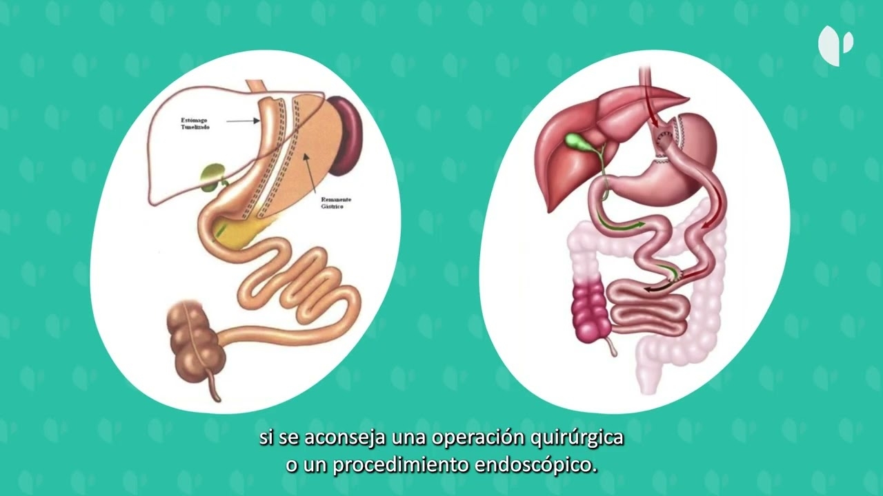 Comprehensive Obesity Unit at Hospital Quirónsalud Marbella