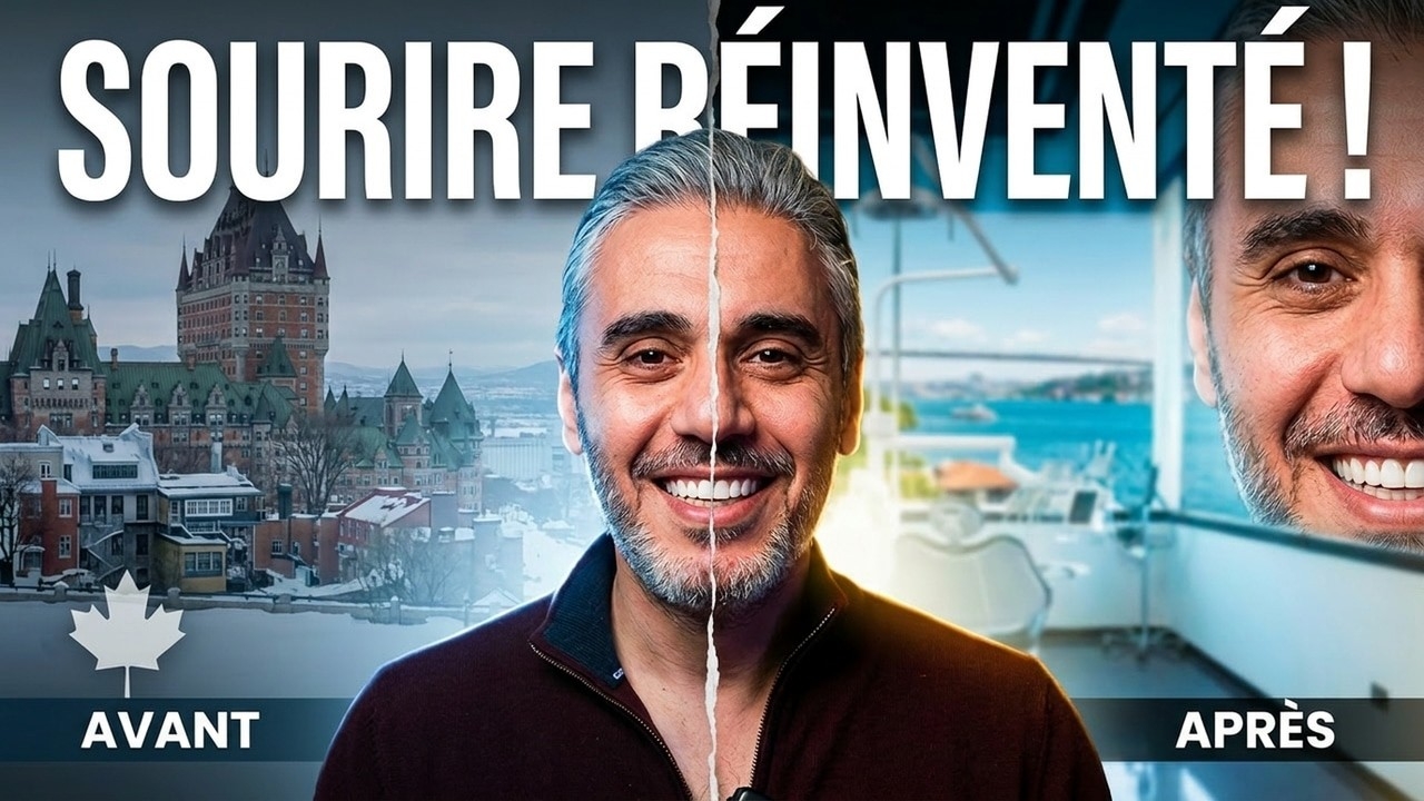 ⭐ Farid: From Canada to Istanbul, his smile reinvented by Mira Clinic ✨