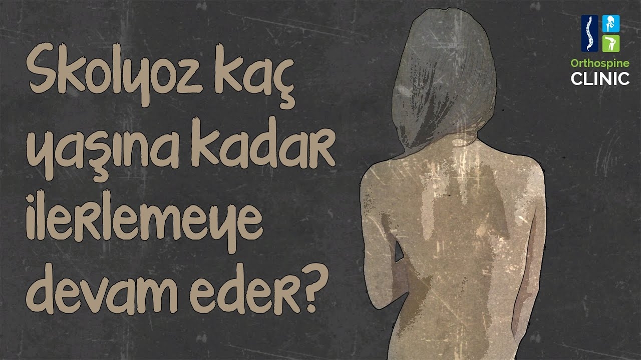 Until how old does scoliosis continue to progress?