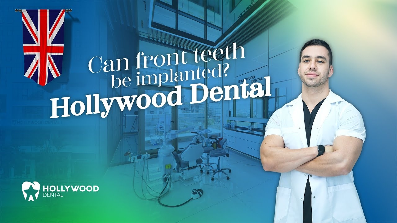 Can Front Teeth Be Implanted?