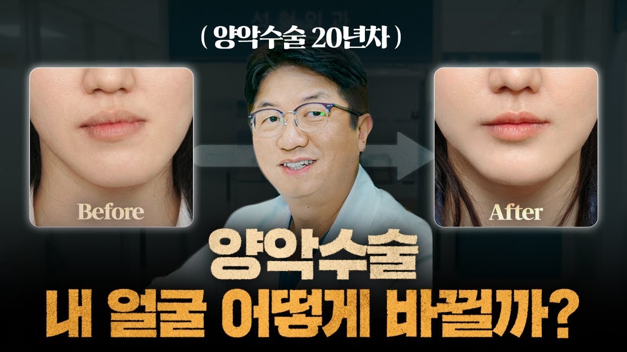 Before jaw surgery, you can preview the results | A plastic surgery professor with 20 years of experience talks about the latest safe jaw surgery