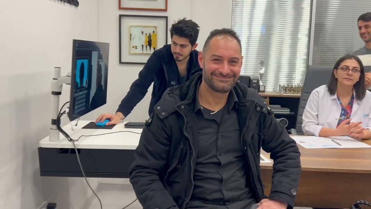 From Italy to Estecapelli I A Journey of Hair Restoration Success!