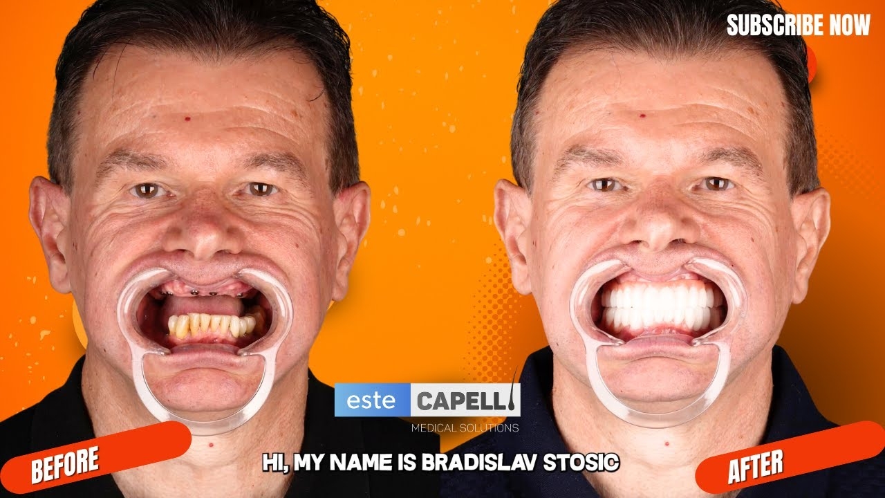 Bradislav’s New Smile I The Dental Procedure Journey