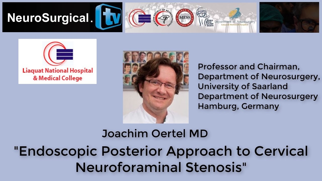 Joachim Oertel MD: Endoscopic Posterior Approach to Cervical Neuroforaminal stenosis
