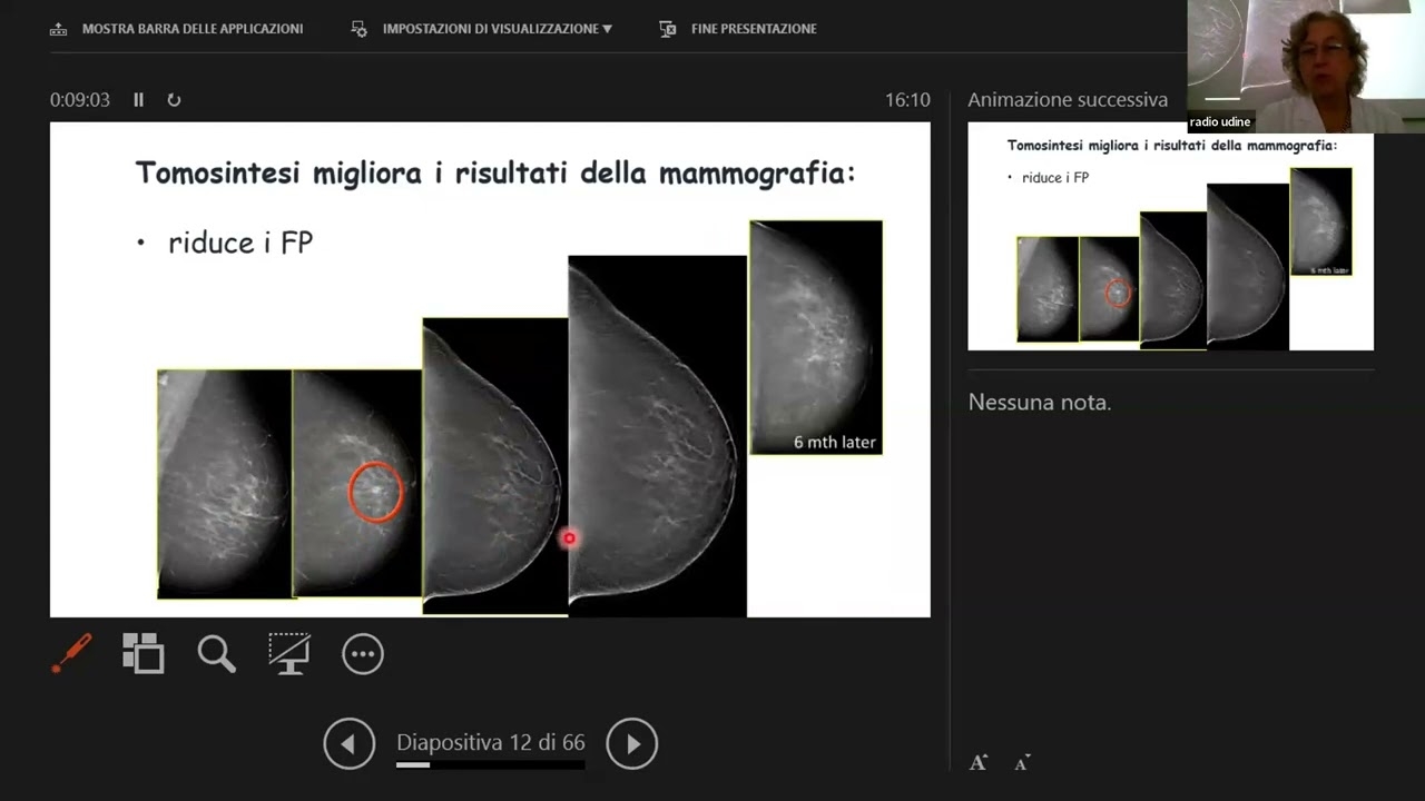 23.6) Breast neoplasms - Prof. Zuiani and Prof. Sardanelli, Presented by Prof. Belli