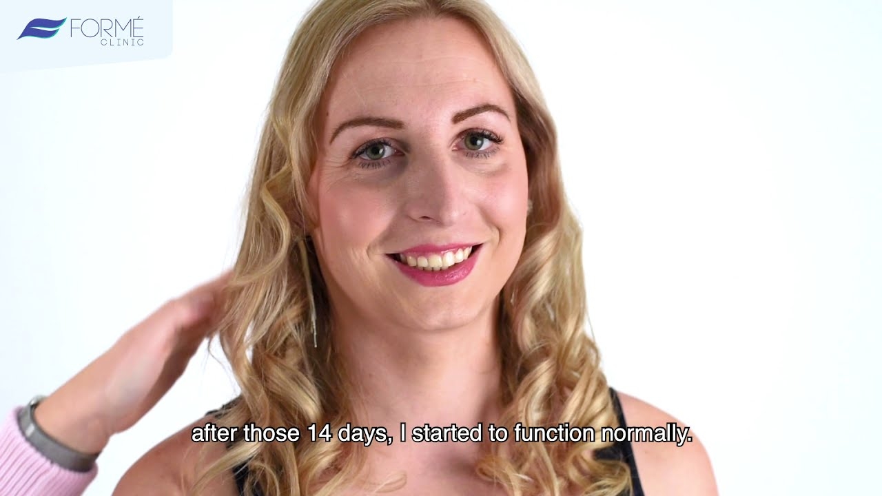 Míša (36) - Breast augmentation with silicone implant