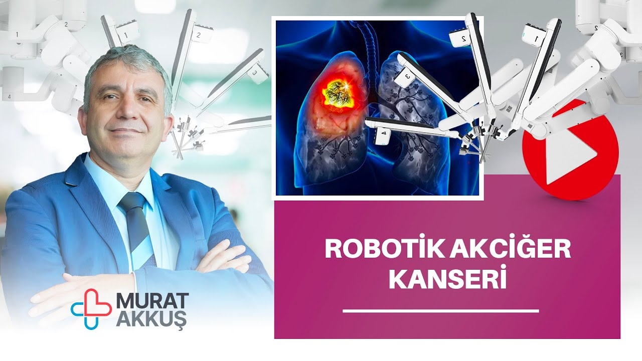 Prof. Dr. Murat Akkuş gave information about lung cancer on TV8!