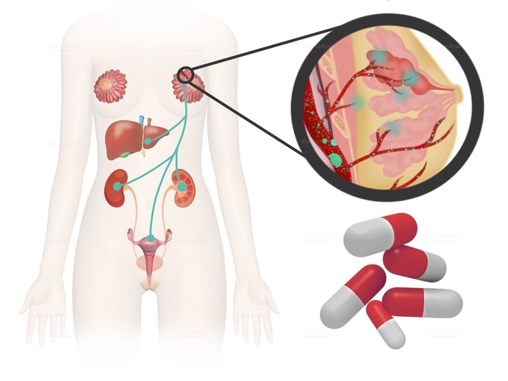 225 Ac-DOTA-LM3 PRRT for Neuroendocrine Tumors | Saarland University Hospital