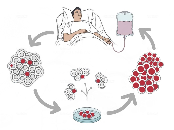 Radiosynoviorthesis (Radiatic Synovectomy) for Chronic Inflammatory Joint Diseases | Saarland University Hospital