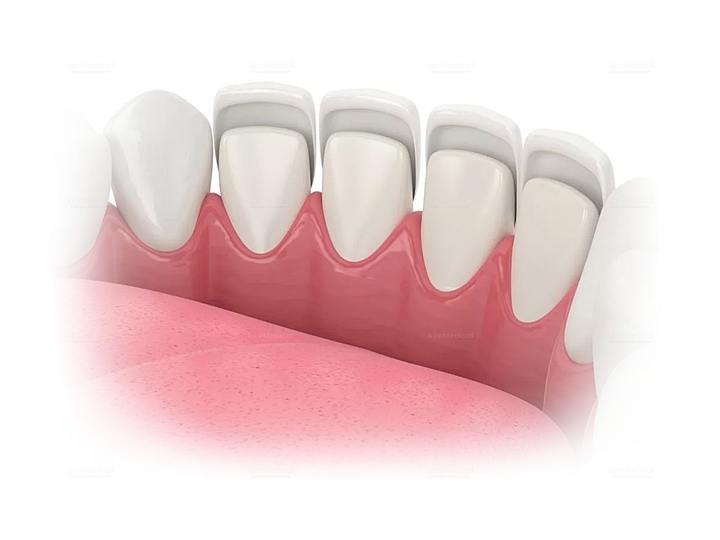 Orthognatic Surgery at Clinic for Oral & Maxillofacial Surgery TUM University Hospital Rechts der Isar