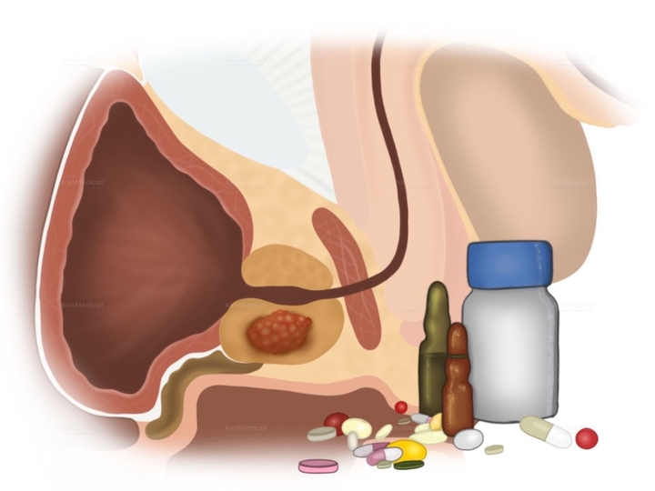 Fibroblast Activation Protein (FAP)-Targeted Radionuclide Therapy for Solid Tumors | Helios Clinic Berlin-Buch, Germany