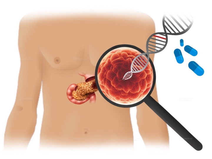 Whipple Surgery (Pancreaticoduodenectomy) for Pancreatic Tumor | TUM University Hospital Rechts der Isar in Munich