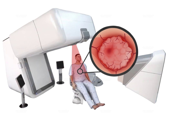 Proton Therapy of Eye Tumors at Charité University Hospital Berlin