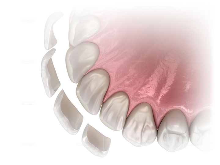 Parkinson's Disease Diagnostic Program + Management Plan | Beta Clinic Bonn
