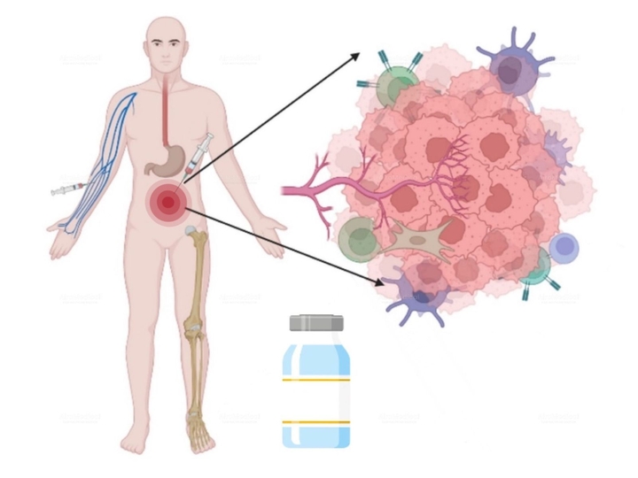 Regional Chemotherapy (RCT) - Isolated Hypoxic Pelvic Perfusion (HPP) | Oncological Clinic Medias in Burghausen, Germany