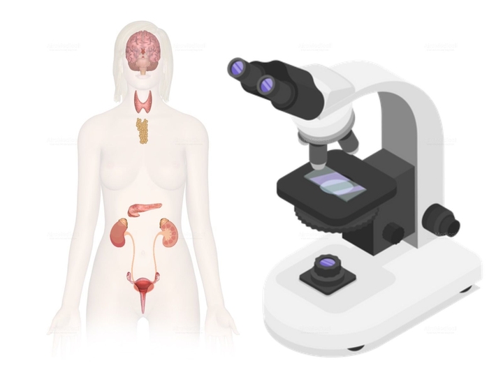 Transcranial Pulse Stimulation (TPS) for Alzheimer’s / Dementia / Parkinson’s / Stroke at Centre of Advanced Medicine, Frankfurt, Germany