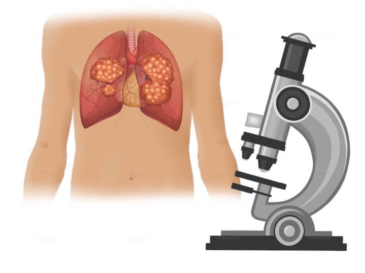 Herniated Disc Surgery Package | Spine Center at Solingen Municipal Hospital