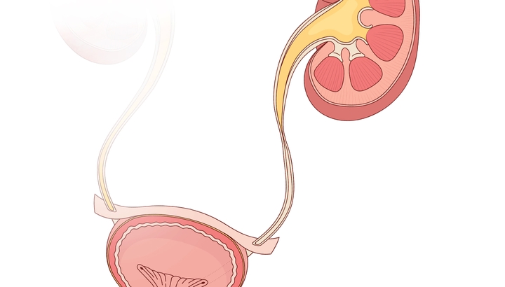 Robotic Ureteral Reimplantation Into Bladder for Ureteral Stricture | Urological Clinic of TUM University Hospital Rechts der Isar