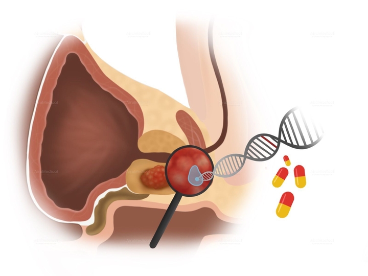 FAP-targeted radioligand therapy Lu-177–FAPI for Tumors | Theranostics Section of TUM University Hospital Rechts der Isar