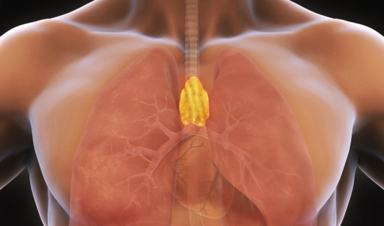 Thymus Cancer Guide image