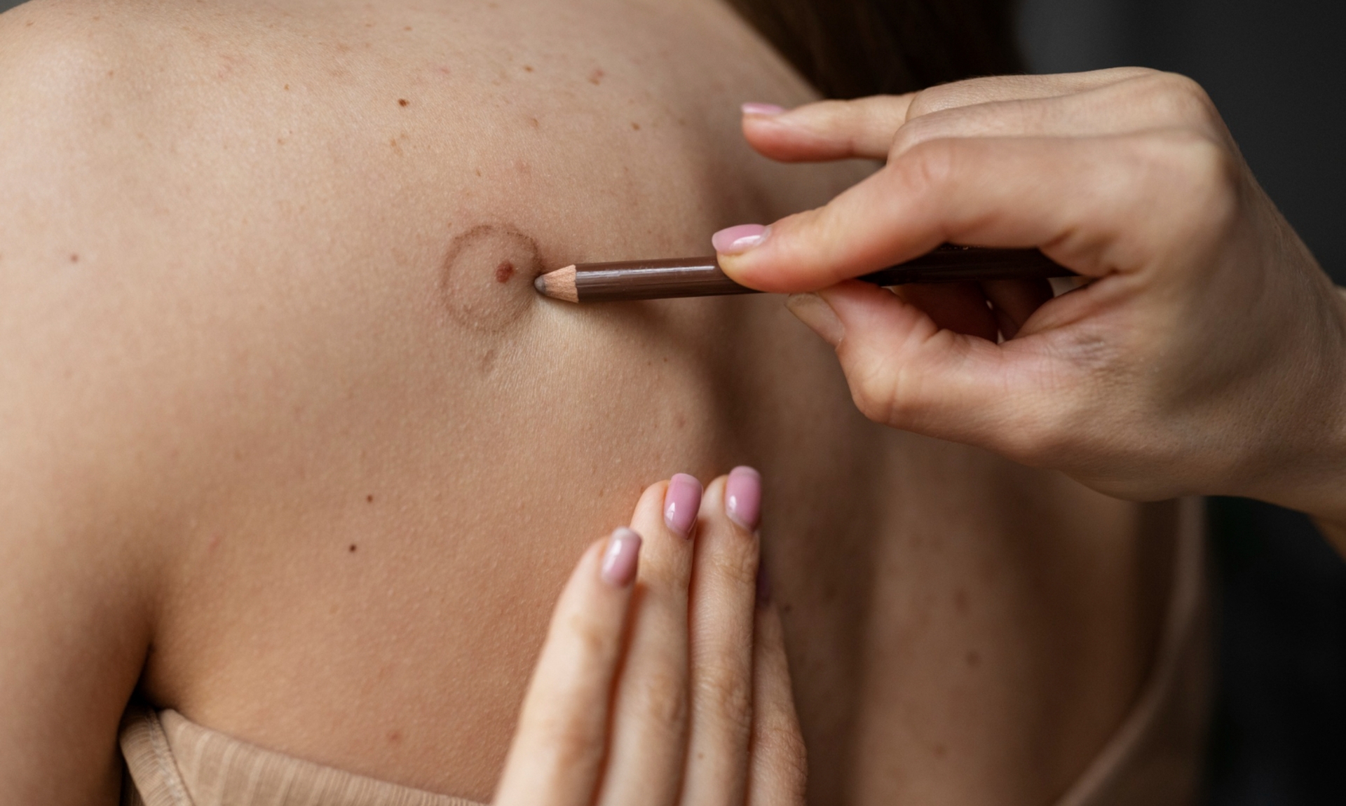 Best Mohs Surgery Clinics in Europe image