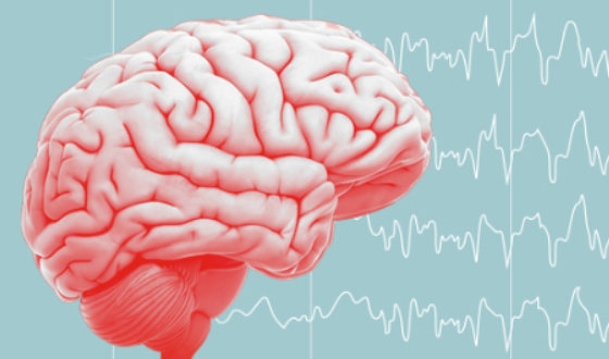 Epilepsy Guide image