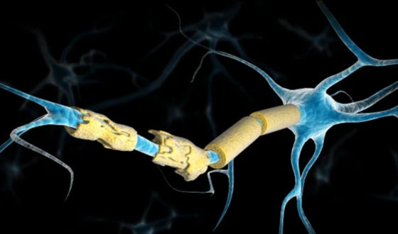 Multiple Sclerosis Guide image