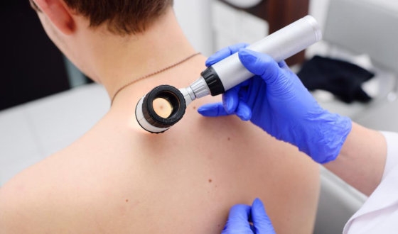 Best Mohs Surgery Clinics and Surgeons image