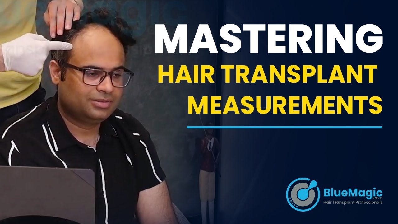 Mastering Hair Transplant Measurements: Your Ultimate Guide to Optimal Results