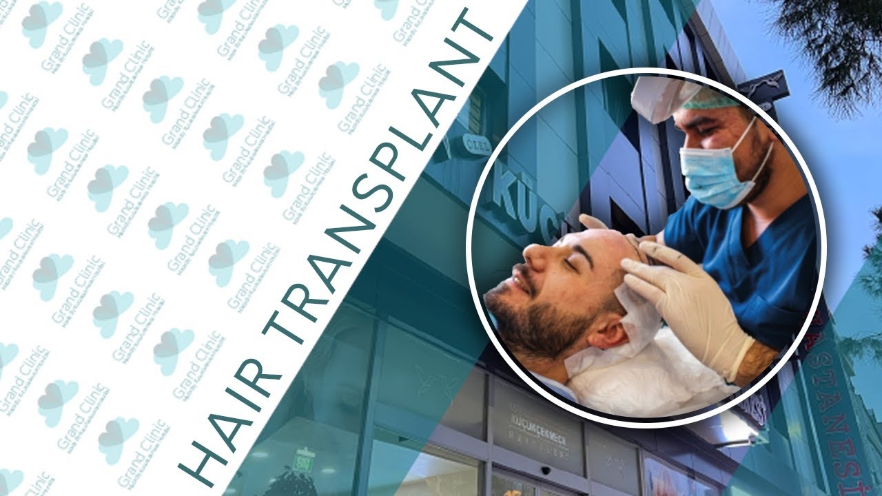 Hair Transplantation in Turkey