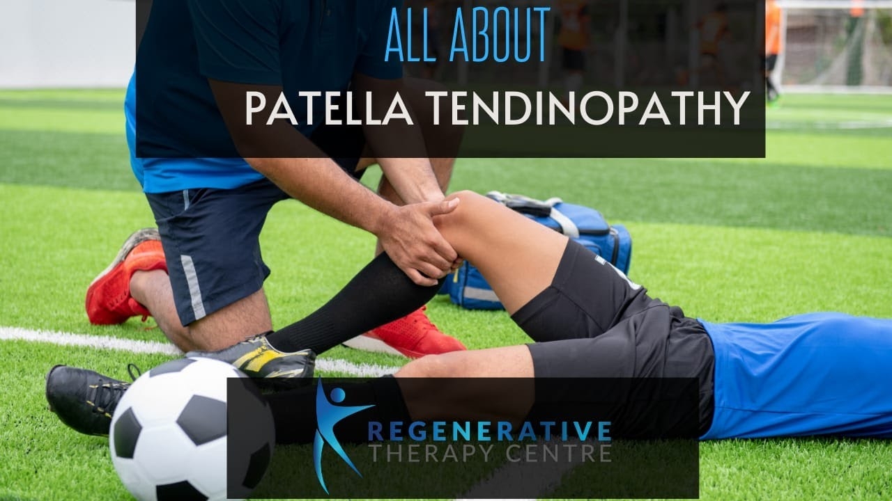 PATELLA TENDINOPATHY- All you need to know About!