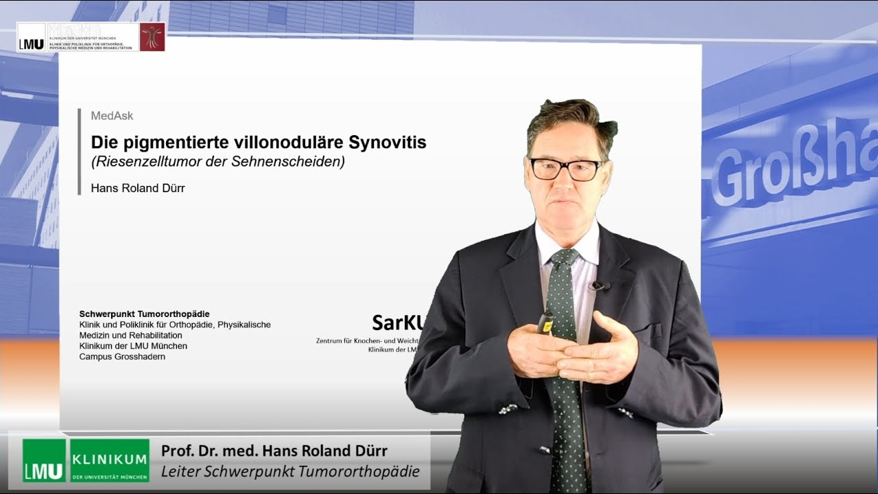 Pigmented villonodular synovitis (giant cell tumor of the tendon sheath)