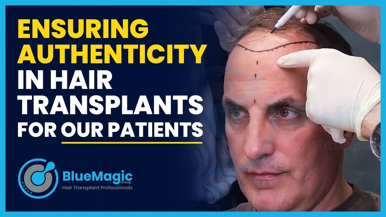 Ensuring Authenticity in Hair Transplants for Our Patients