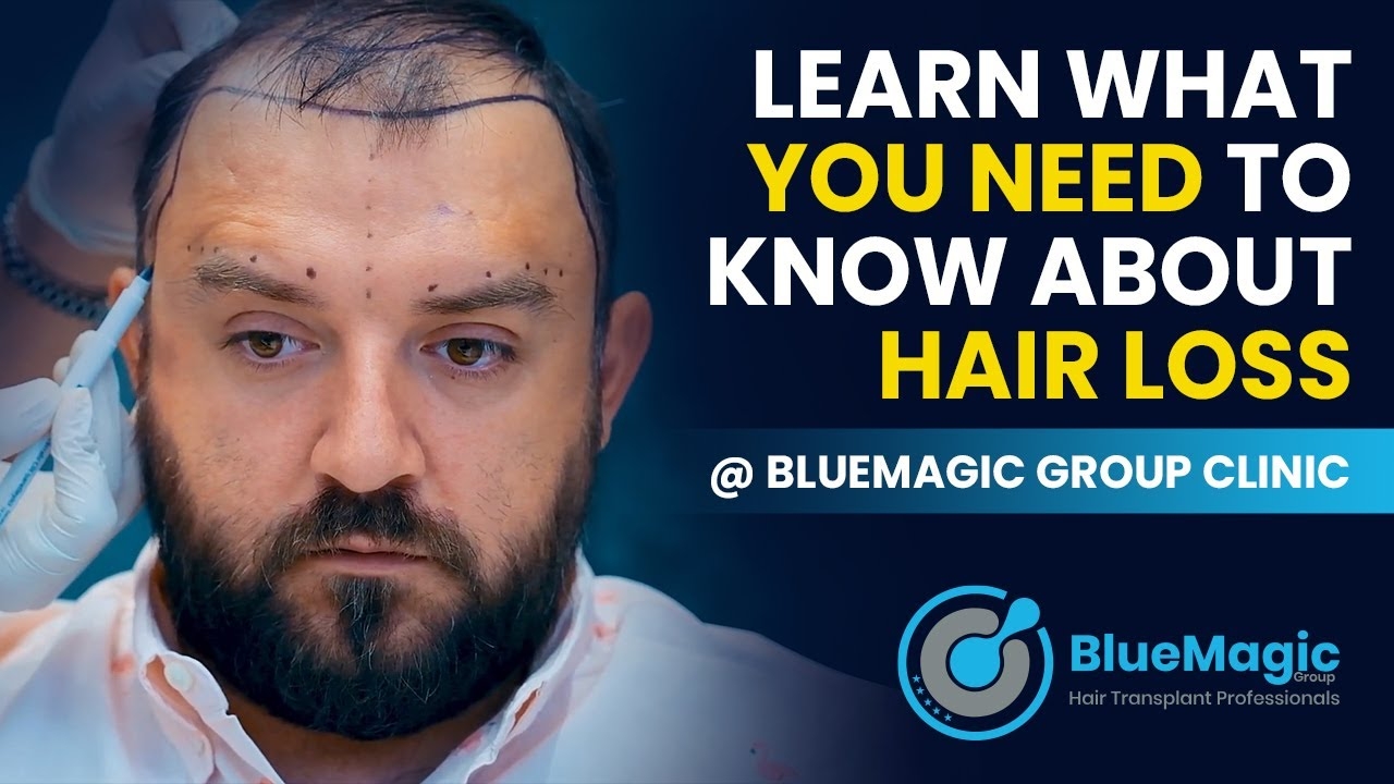 Learn What You Need To Know About Hair Loss @ BlueMagic Group Clinic