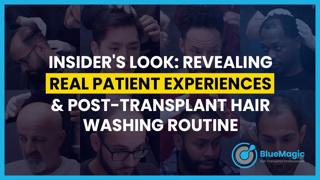 Insider's Look: Revealing Patient Experiences & Post-Transplant Hair Washing Routine
