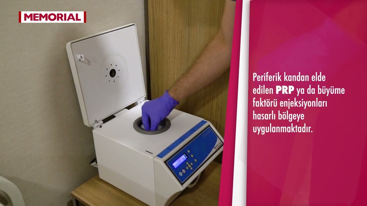 What are the regenerative treatments for knee calcifications, meniscus and muscle tears?