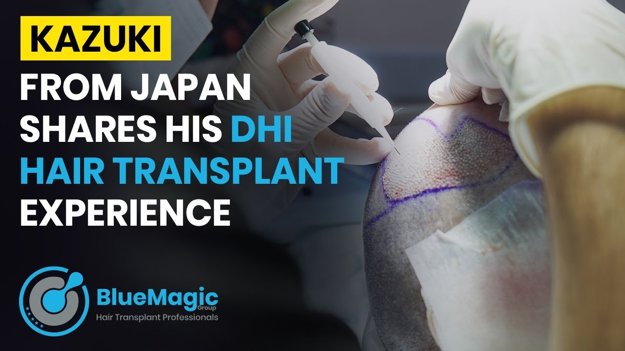 Kazuki From Japan Shares His DHI Hair Transplant Experience | BlueMagic Group International