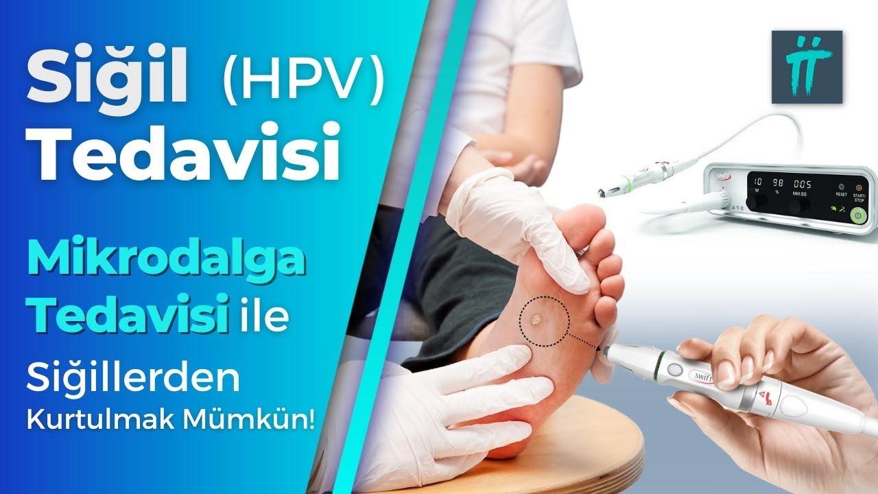 Wart Treatment (HPV Treatment): How to Remove Wart Root? I Turan&Turan