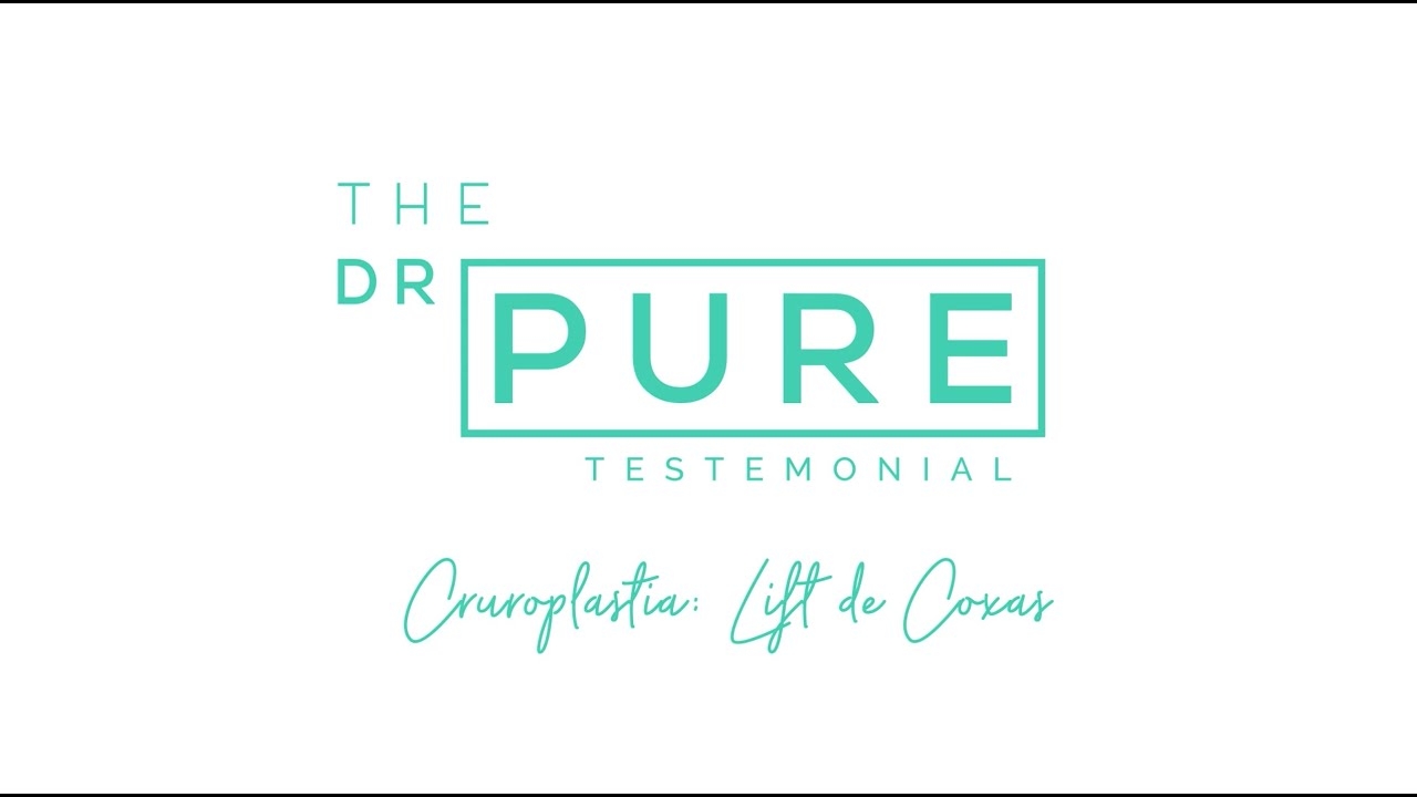Cruroplasty: Thigh Lift - The Dr PURE Testimonial