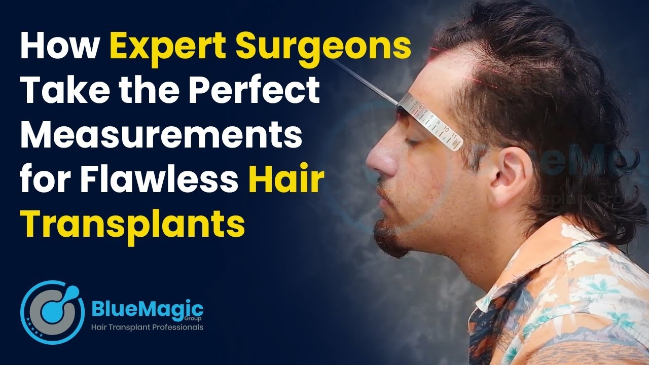 Mastering Precision: How Expert Surgeons Take the Perfect Measurements for Flawless Hair Transplants