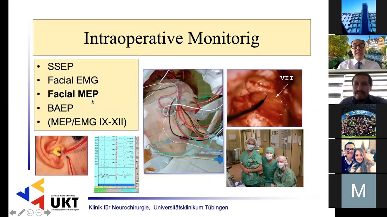 Dr. Marcos Soares Tatagiba Surgical Treatment of Vestibular Schwannomas