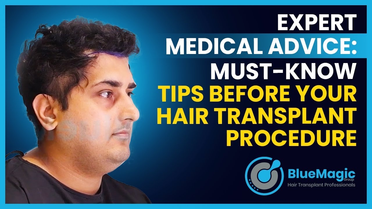Expert Medical Advice: Must-Know Tips Before Your Hair Transplant Procedure